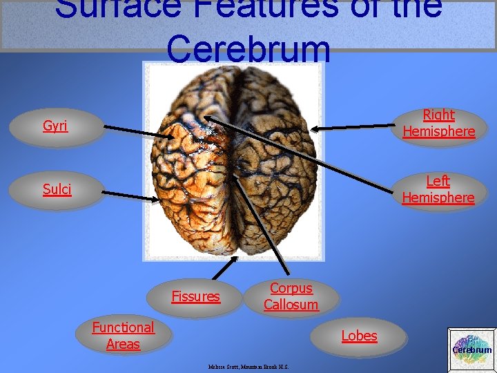 Surface Features of the Cerebrum Gyri Right Hemisphere Sulci Left Hemisphere Fissures Corpus Callosum
