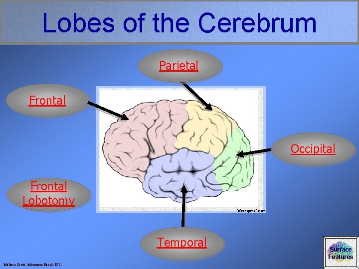 Lobes of the Cerebrum Parietal Frontal Occipital Frontal Lobotomy Microspft Clipart Temporal Melissa Scott,