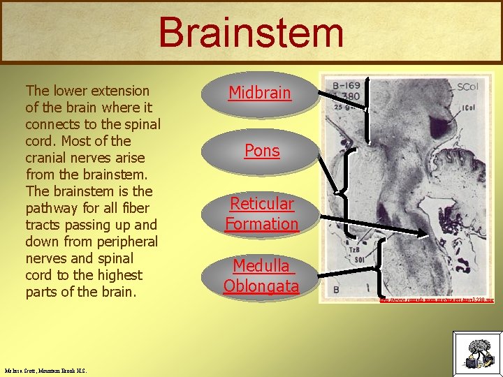 Brainstem The lower extension of the brain where it connects to the spinal cord.