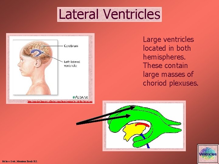 Lateral Ventricles Large ventricles located in both hemispheres. These contain large masses of choriod