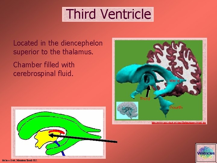 Third Ventricle Located in the diencephelon superior to the thalamus. Chamber filled with cerebrospinal