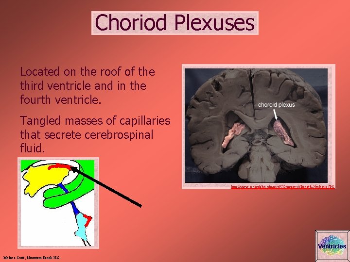 Choriod Plexuses Located on the roof of the third ventricle and in the fourth