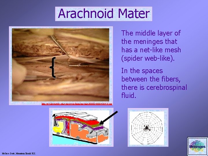 Arachnoid Mater The middle layer of the meninges that has a net-like mesh (spider