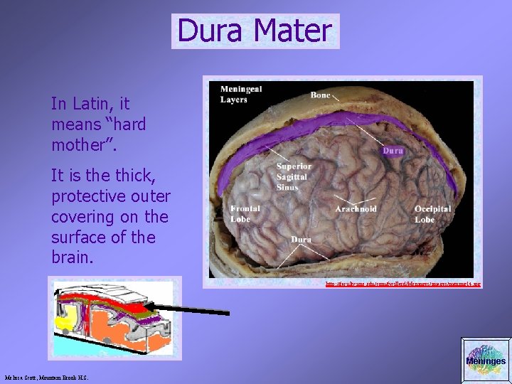 Dura Mater In Latin, it means “hard mother”. It is the thick, protective outer