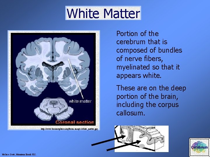 White Matter Portion of the cerebrum that is composed of bundles of nerve fibers,