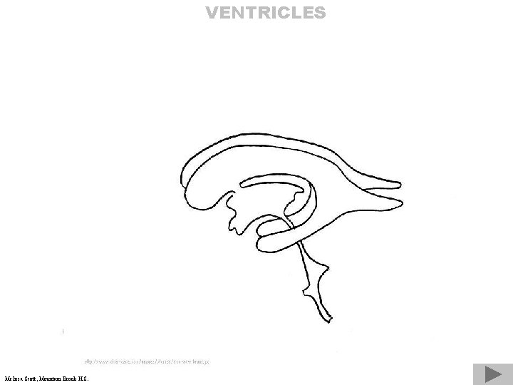 VENTRICLES Melissa Scott, Mountain Brook H. S. 