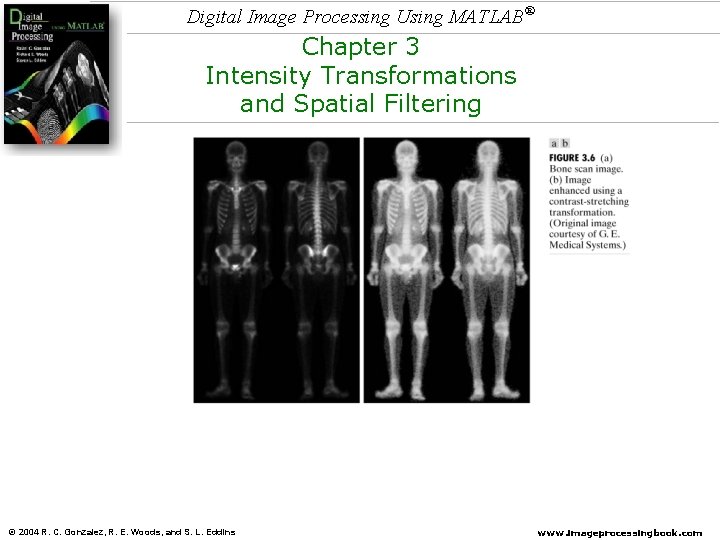 Digital Image Processing Using MATLAB® Chapter 3 Intensity Transformations and Spatial Filtering © 2004 Digital Image Processing Using MATLAB® Chapter 3 Intensity Transformations and Spatial Filtering © 2004