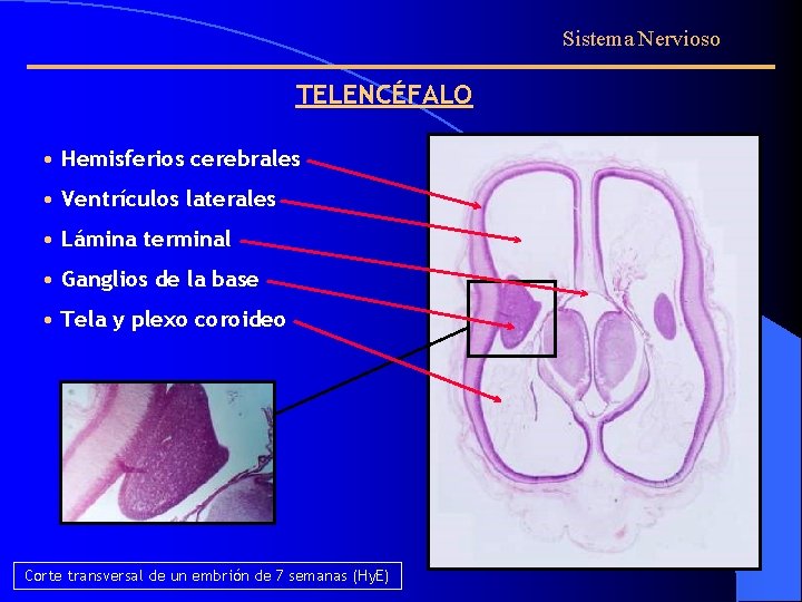 Sistema Nervioso TELENCÉFALO • Hemisferios cerebrales • Ventrículos laterales • Lámina terminal • Ganglios