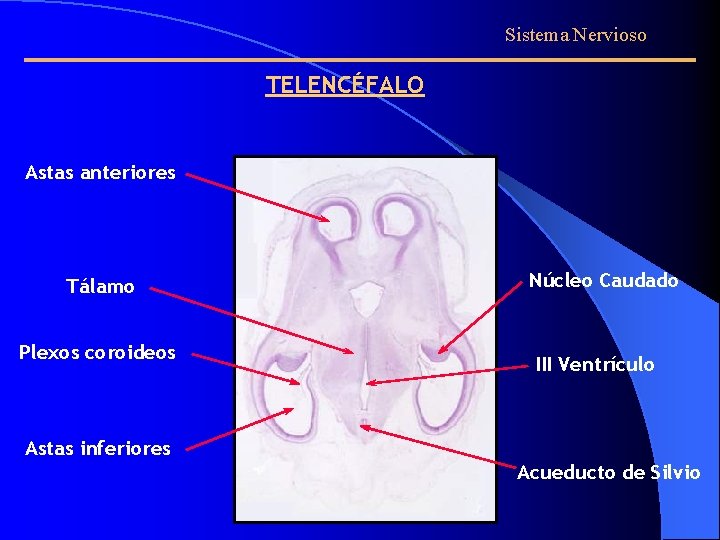 Sistema Nervioso TELENCÉFALO Astas anteriores Tálamo Plexos coroideos Núcleo Caudado III Ventrículo Astas inferiores