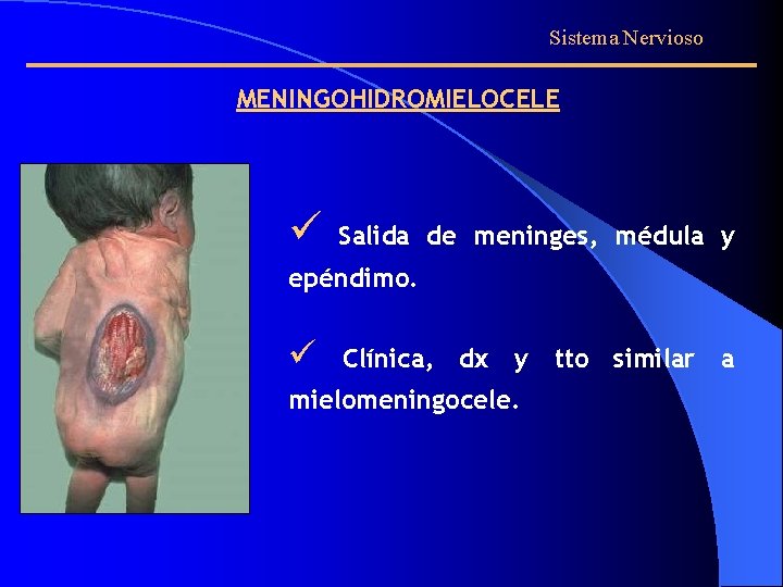 Sistema Nervioso MENINGOHIDROMIELOCELE ü Salida de meninges, médula y epéndimo. ü Clínica, dx y