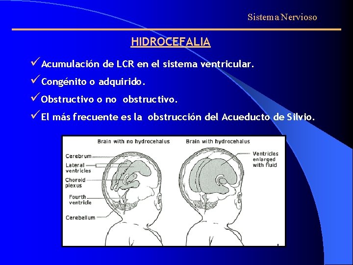 Sistema Nervioso HIDROCEFALIA üAcumulación de LCR en el sistema ventricular. üCongénito o adquirido. üObstructivo