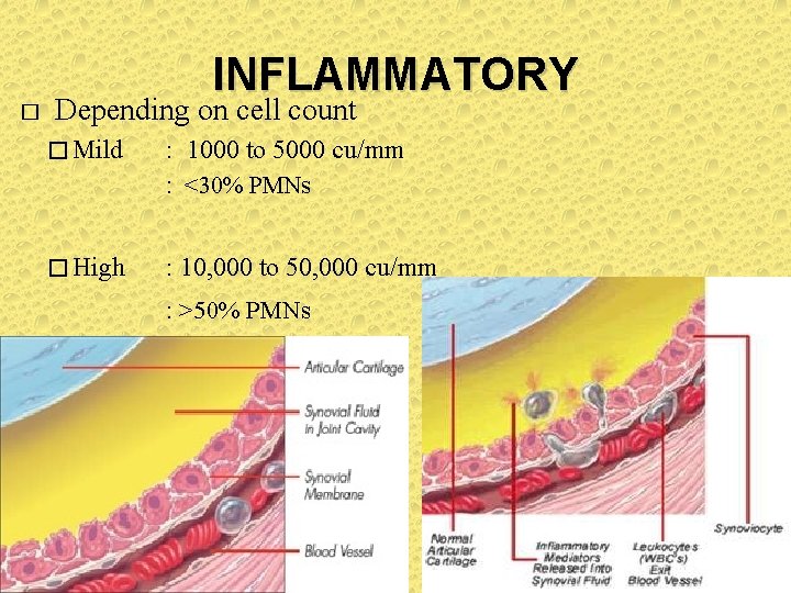 INFLAMMATORY � Depending on cell count � Mild : 1000 to 5000 cu/mm :