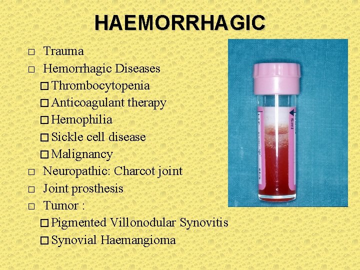 HAEMORRHAGIC � � � Trauma Hemorrhagic Diseases � Thrombocytopenia � Anticoagulant therapy � Hemophilia