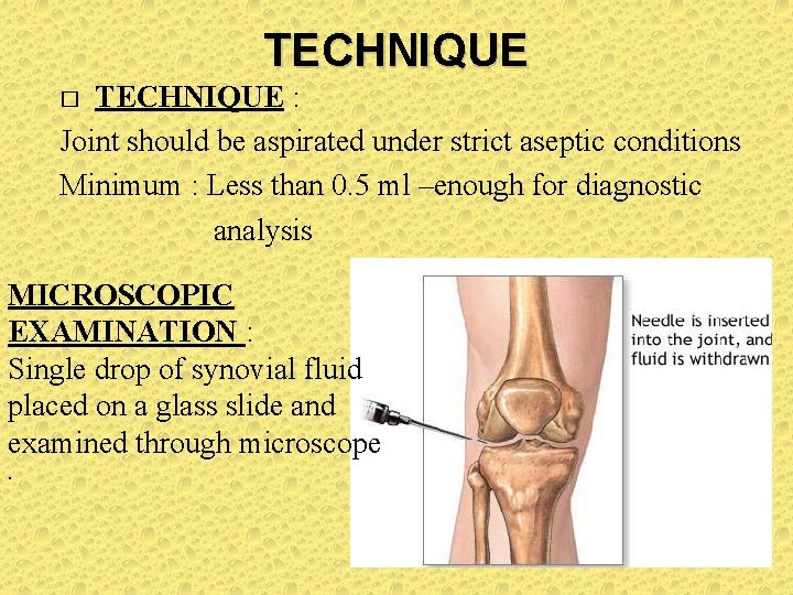 TECHNIQUE : Joint should be aspirated under strict aseptic conditions Minimum : Less than TECHNIQUE : Joint should be aspirated under strict aseptic conditions Minimum : Less than