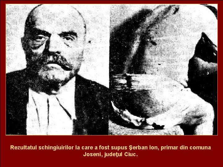 Rezultatul schingiuirilor la care a fost supus Şerban Ion, primar din comuna Joseni, judeţul