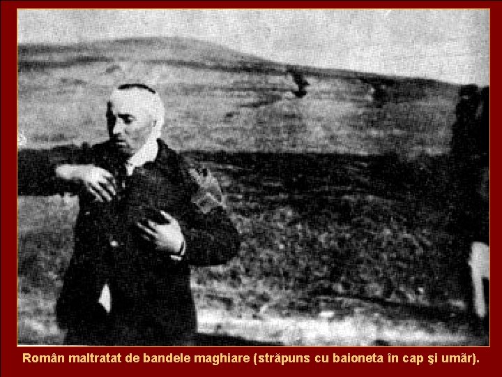 Român maltratat de bandele maghiare (străpuns cu baioneta în cap şi umãr). 