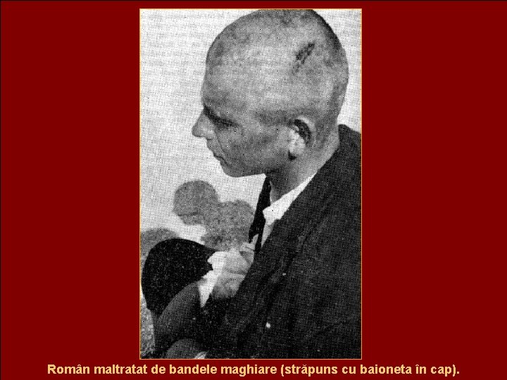 Român maltratat de bandele maghiare (străpuns cu baioneta în cap). 