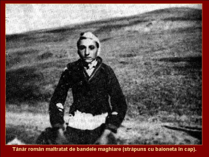 Tânăr român maltratat de bandele maghiare (străpuns cu baioneta în cap). 