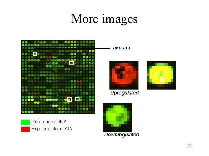 More images Gene GTF 4 Upregulated Reference c. DNA Experimental c. DNA Downregulated 12