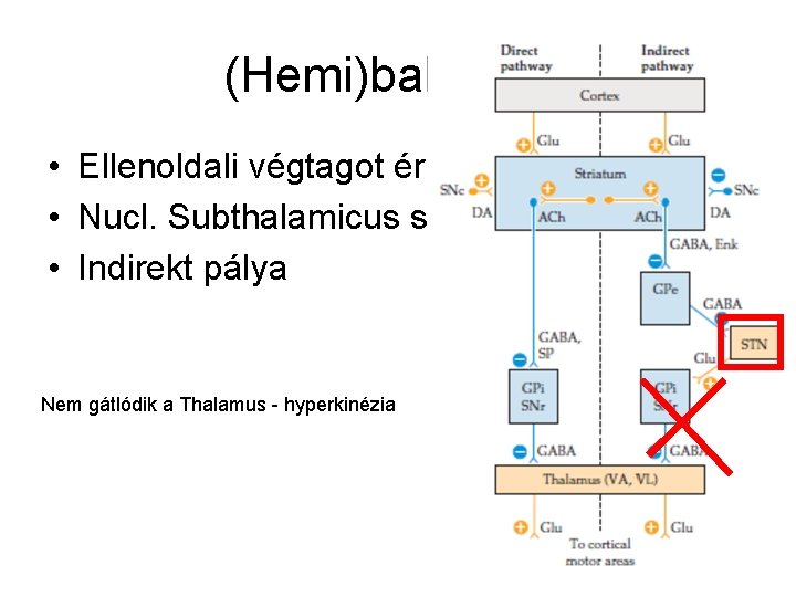 (Hemi)ballizmus • Ellenoldali végtagot érint • Nucl. Subthalamicus sérülés • Indirekt pálya Nem gátlódik