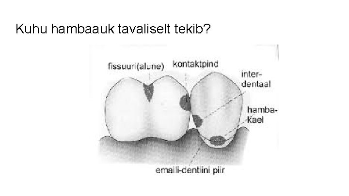 Kuhu hambaauk tavaliselt tekib? 