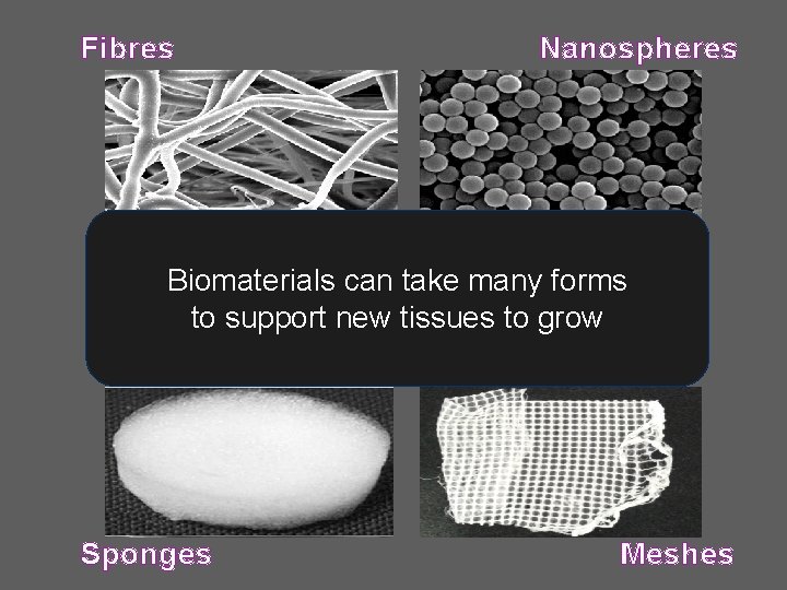 Fibres Nanospheres Biomaterials can take many forms to support new tissues to grow Sponges