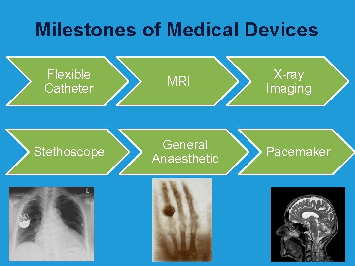 Milestones of Medical Devices Flexible Catheter Stethoscope MRI General Anaesthetic X-ray Imaging Pacemaker 