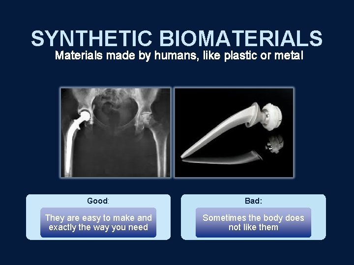 SYNTHETIC BIOMATERIALS Materials made by humans, like plastic or metal Good: Bad: They are