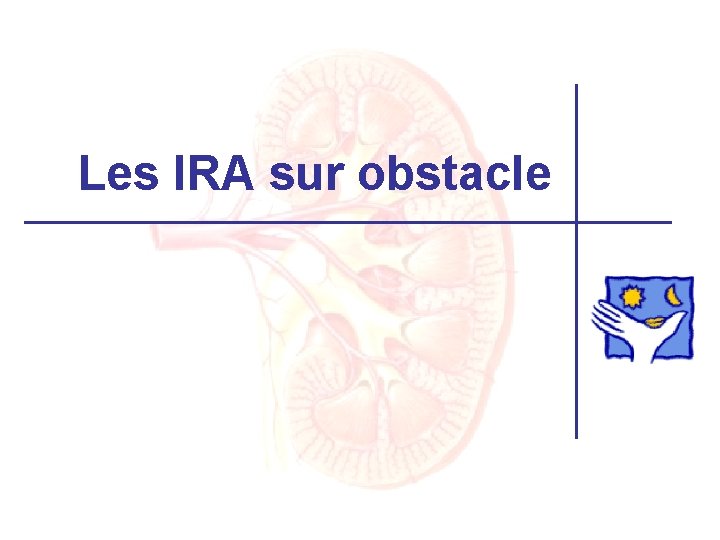 Les IRA sur obstacle 