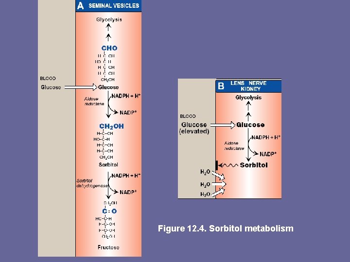 Figure 12. 4. Sorbitol metabolism 