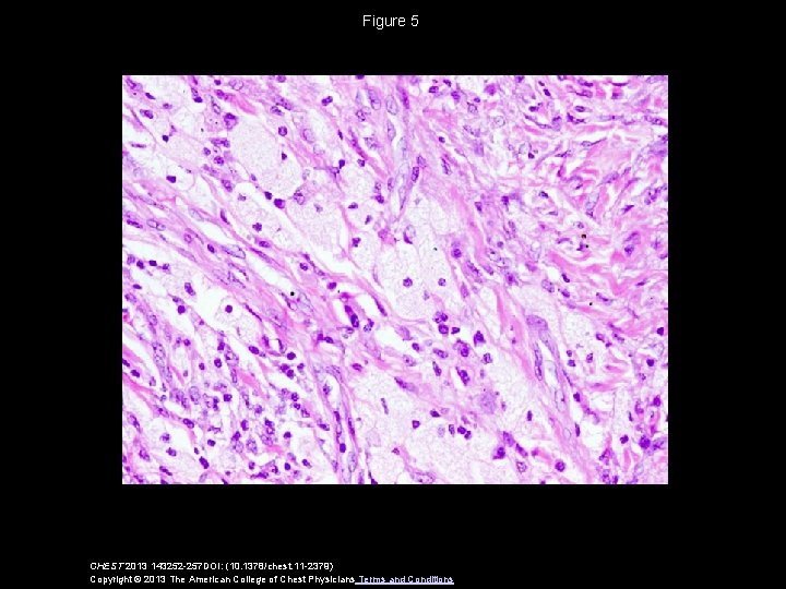 Figure 5 CHEST 2013 143252 -257 DOI: (10. 1378/chest. 11 -2379) Copyright © 2013