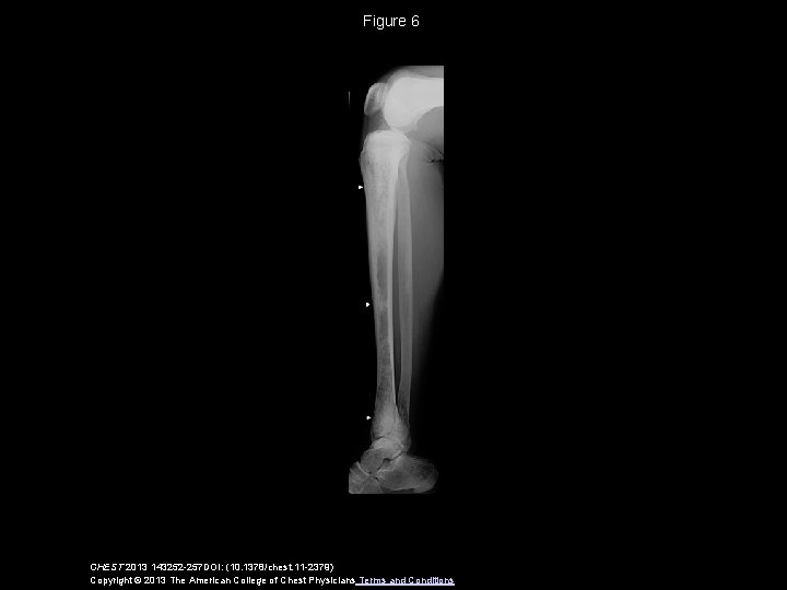 Figure 6 CHEST 2013 143252 -257 DOI: (10. 1378/chest. 11 -2379) Copyright © 2013
