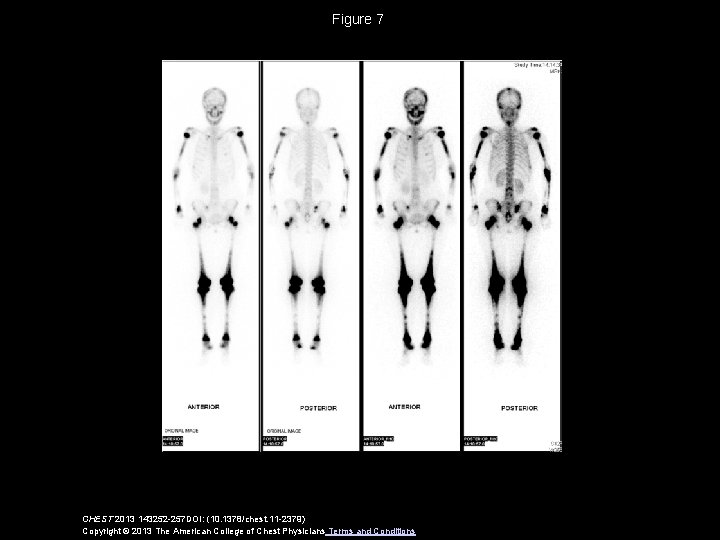 Figure 7 CHEST 2013 143252 -257 DOI: (10. 1378/chest. 11 -2379) Copyright © 2013