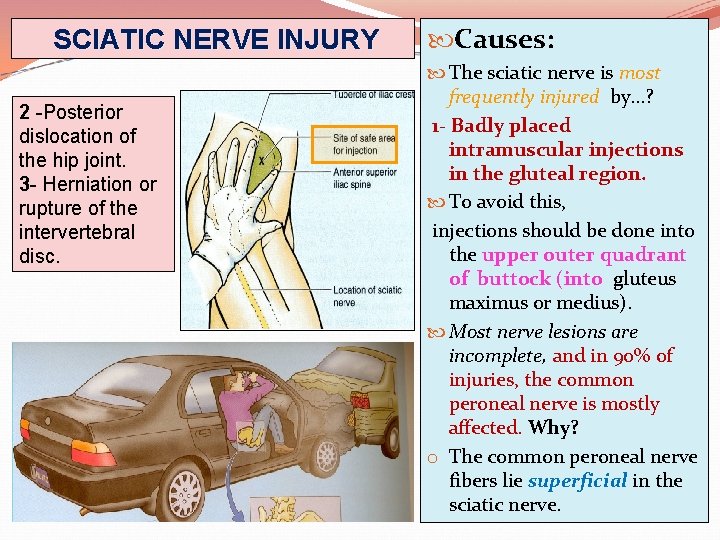 SCIATIC NERVE INJURY 2 -Posterior dislocation of the hip joint. 3 - Herniation or