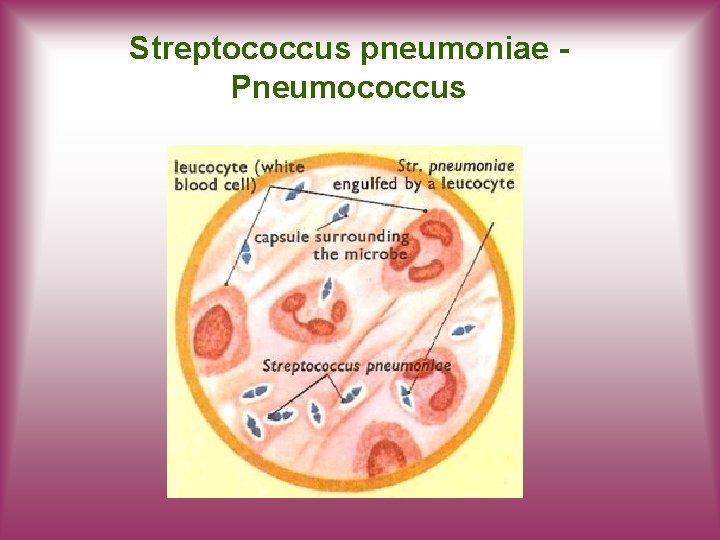 Streptococcus pneumoniae Pneumococcus 