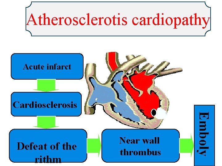 Atherosclerotis cardiopathy Acute infarct Cardiosclerosis Emboly Defeat of the rithm Near wall thrombus 