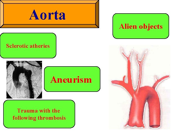 Aorta Sclerotic atheries Aneurism Trauma with the following thrombosis Alien objects 