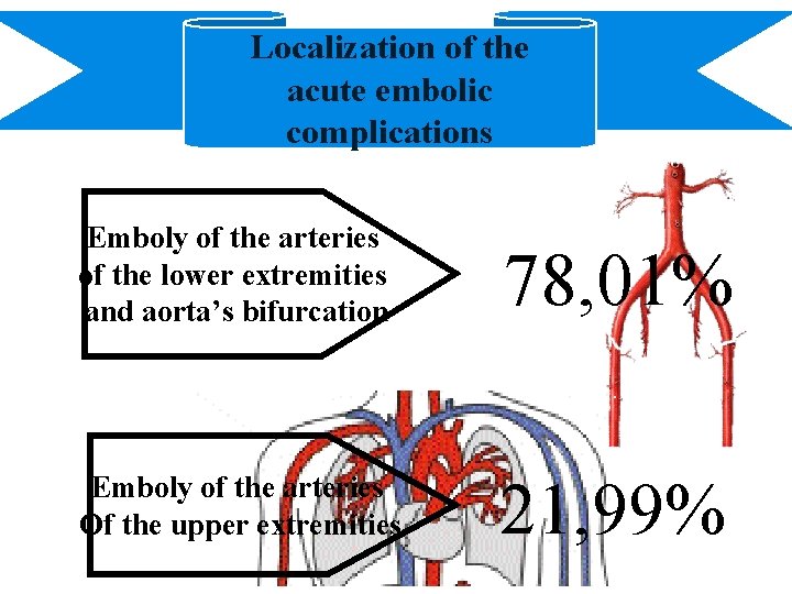 Localization of the acute embolic complications Emboly of the arteries of the lower extremities