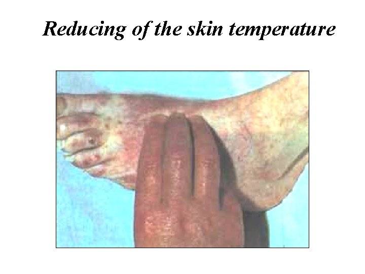 Reducing of the skin temperature 