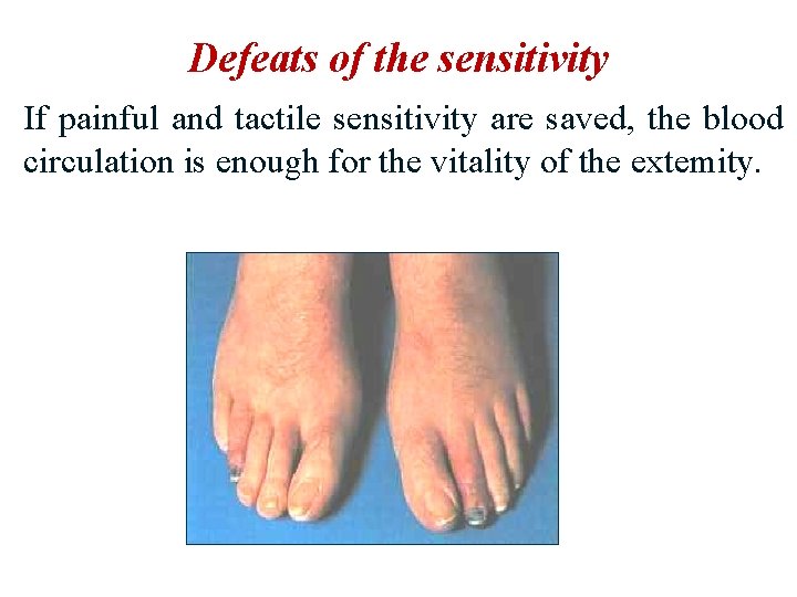 Defeats of the sensitivity If painful and tactile sensitivity are saved, the blood circulation