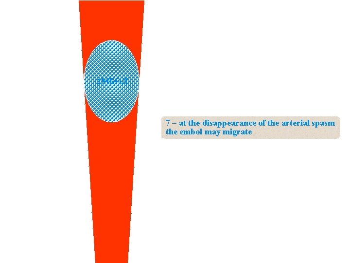 ЭМБОЛ 7 – at the disappearance of the arterial spasm the embol may migrate
