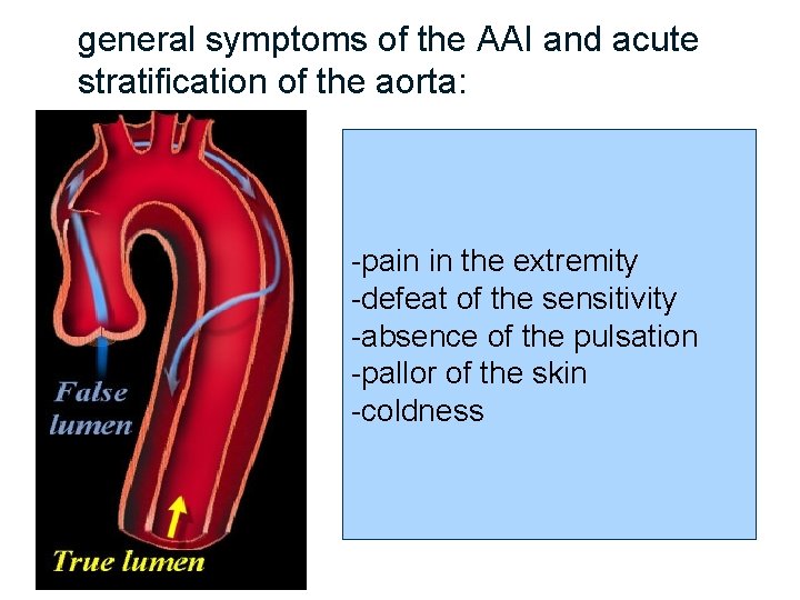  general symptoms of the AAI and acute stratification of the aorta: -pain in