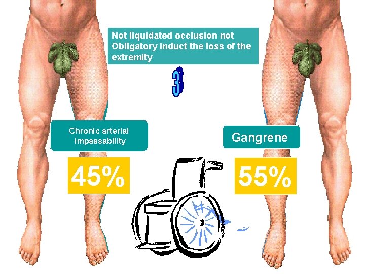 Not liquidated occlusion not Obligatory induct the loss of the extremity Chronic arterial impassability