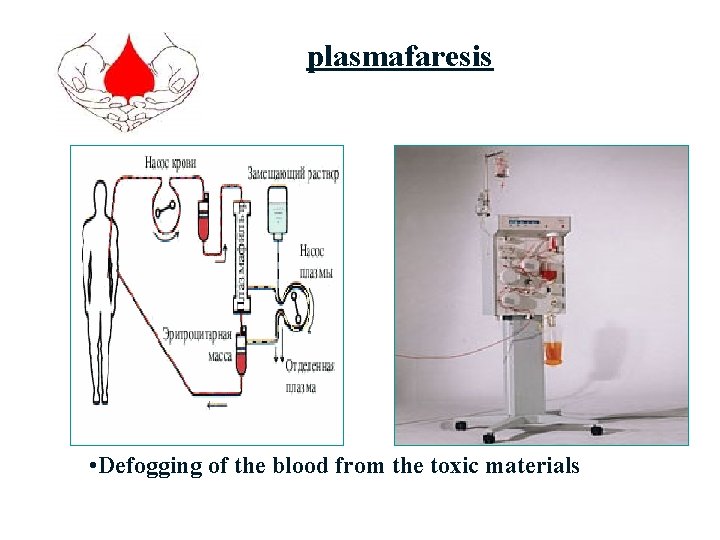 plasmafaresis • Defogging of the blood from the toxic materials 