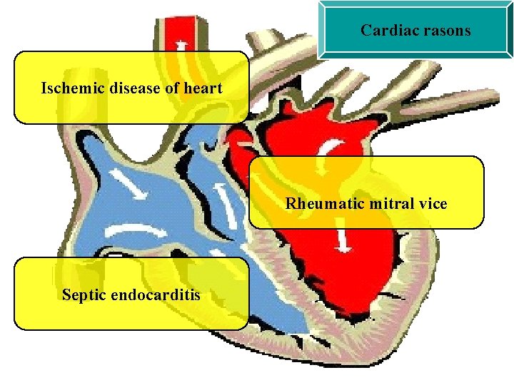 Cardiac rasons Ischemic disease of heart Rheumatic mitral vice Septic endocarditis 