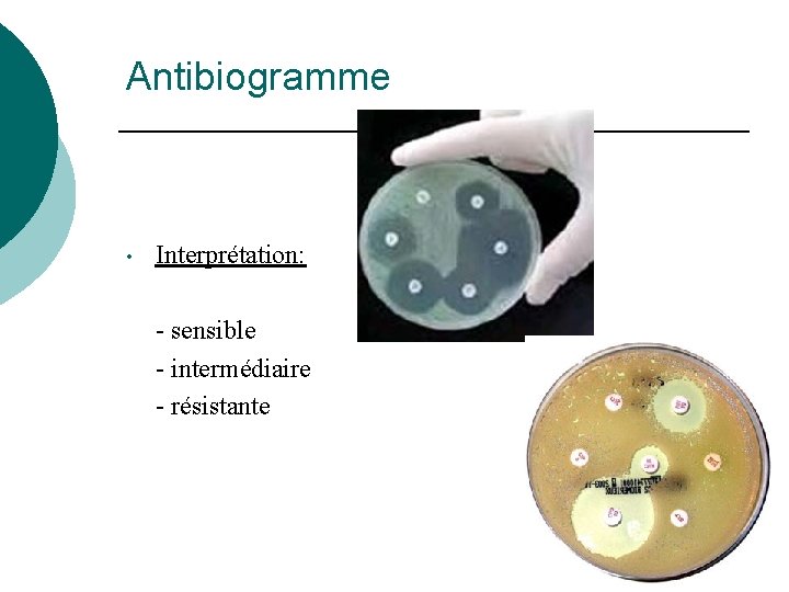 Antibiogramme • Interprétation: - sensible - intermédiaire - résistante 
