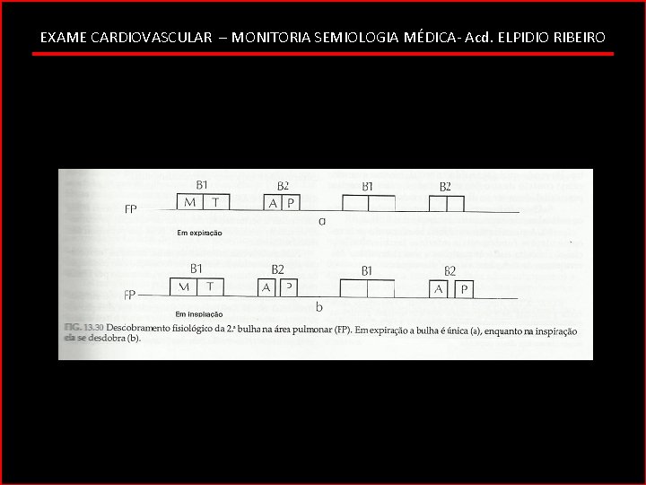 EXAME CARDIOVASCULAR – MONITORIA SEMIOLOGIA MÉDICA- Acd. ELPIDIO RIBEIRO 