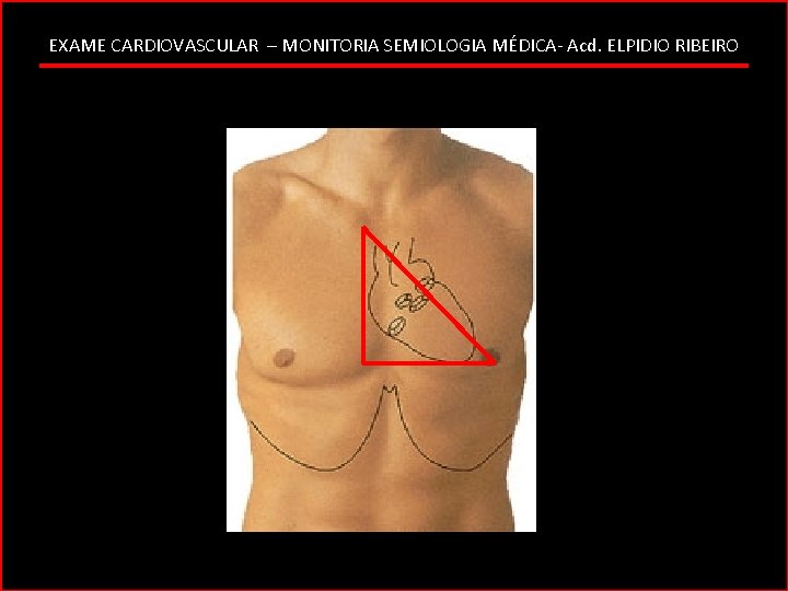 EXAME CARDIOVASCULAR – MONITORIA SEMIOLOGIA MÉDICA- Acd. ELPIDIO RIBEIRO 
