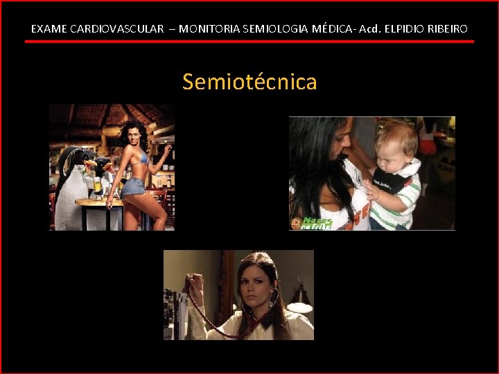 EXAME CARDIOVASCULAR – MONITORIA SEMIOLOGIA MÉDICA- Acd. ELPIDIO RIBEIRO Semiotécnica 
