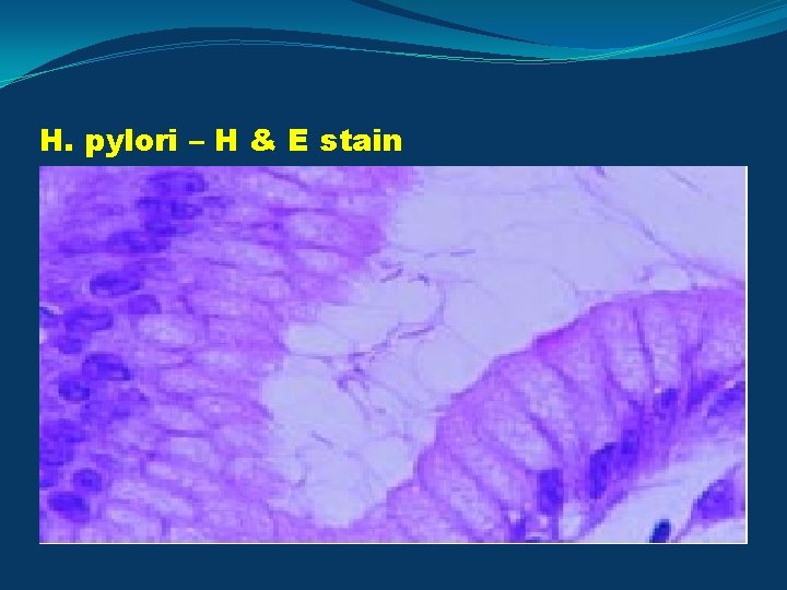 H. pylori – H & E stain 